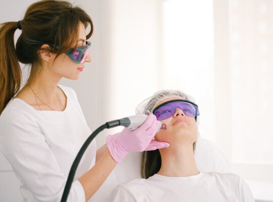 Rf microneedling