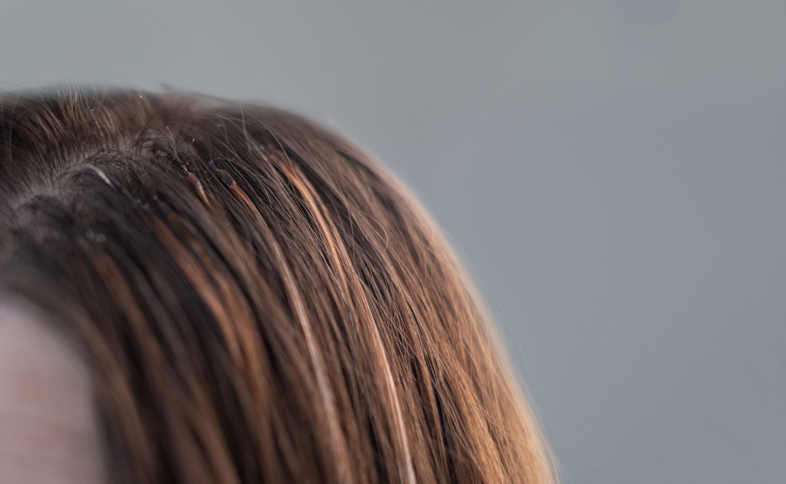 Bonding Extensions_von_Vergleich